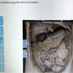 Contents hints using label non solved abdominal provided digestive transcribed problem text been show has